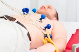 EKG Practice Quiz: ECG Strips and Questions